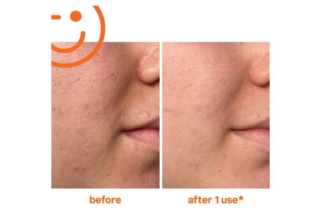 KS Exfolikate Fruit Enzyme Flash Facial Mask Treatment