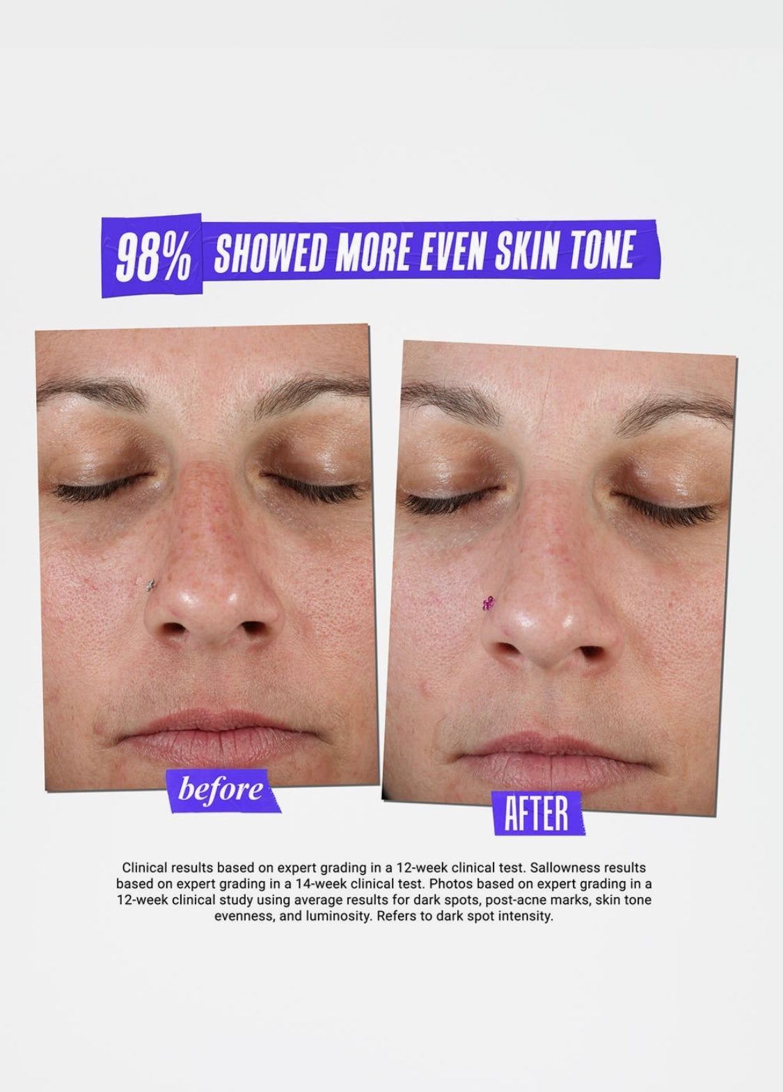 Kiehl’s Clearly Corrective Dark Spot Serum Jumbo Size (3.4 oz)