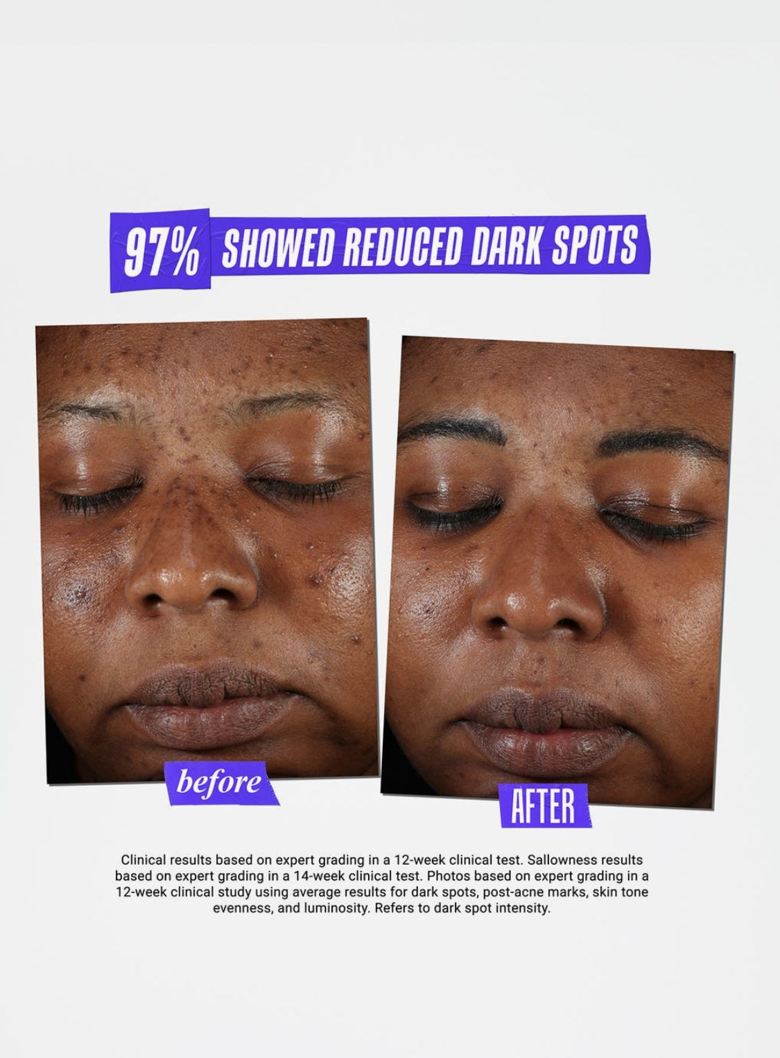 Kiehl’s Clearly Corrective Dark Spot Serum Jumbo Size (3.4 oz)