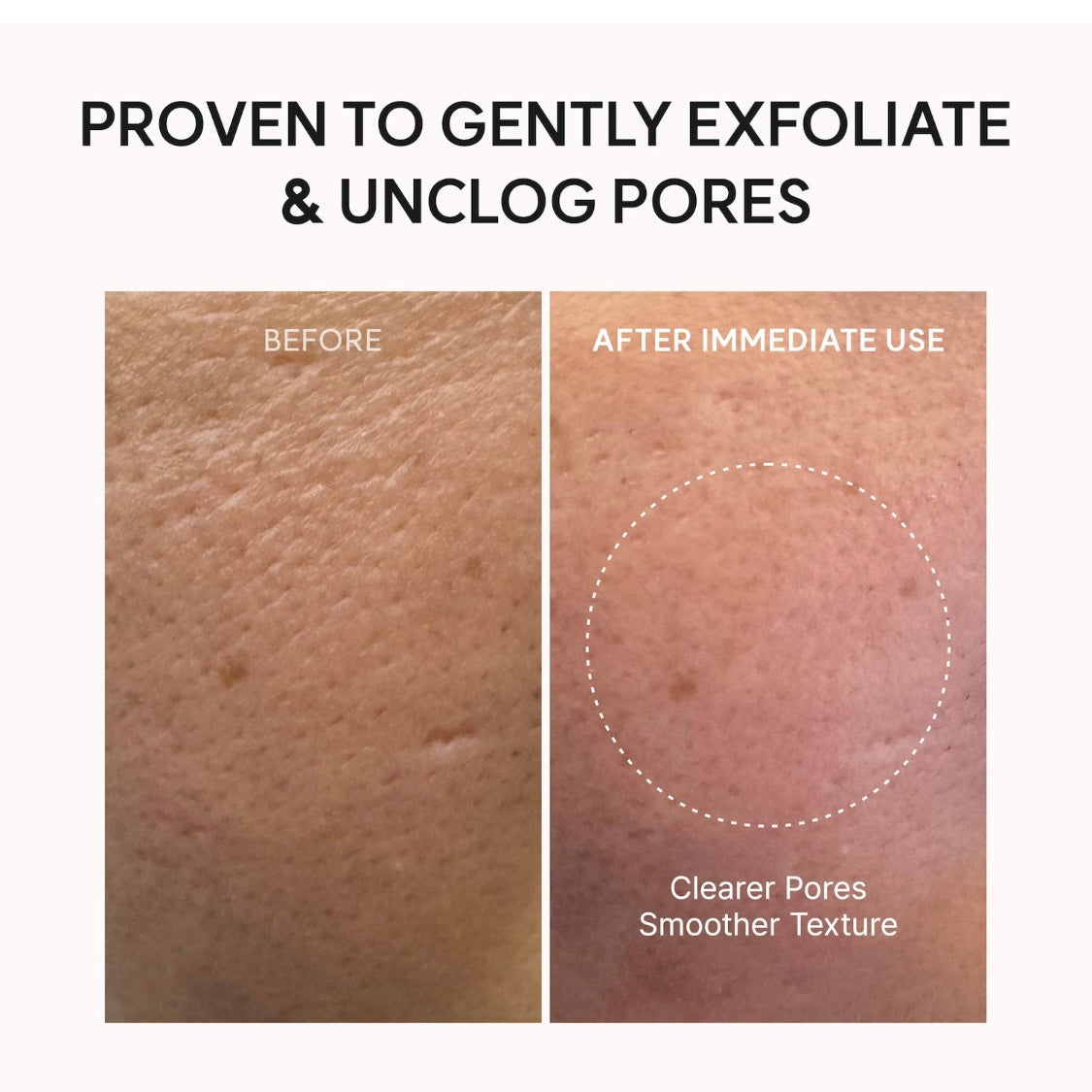 Arencia Fresh Green Rice Mochi Cleanser (4.23 oz)