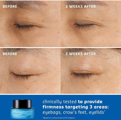 Belif Aqua Bomb Moisturizing Eye Bomb (0.84 oz)